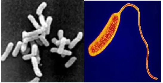 Gambar 4. Pseudomonas sp.(kiri), Campylobacter (kanan) (www.apsnet.org) 