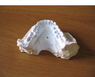 Figure 1.  Plaster teeth arch copy with attached brackets 