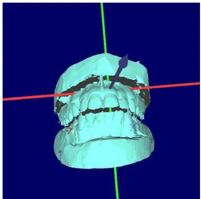 Figure 3.  3D reconstruction process 