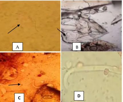 Gambar  3.  Tahap  perkembangan  mikrofilaria  dan  larva  D.  immitis  dalam  tubuh  nyamuk
