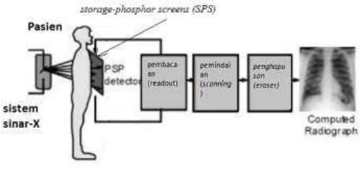 Gambar 2.5 Sistem computed radiography (CR)