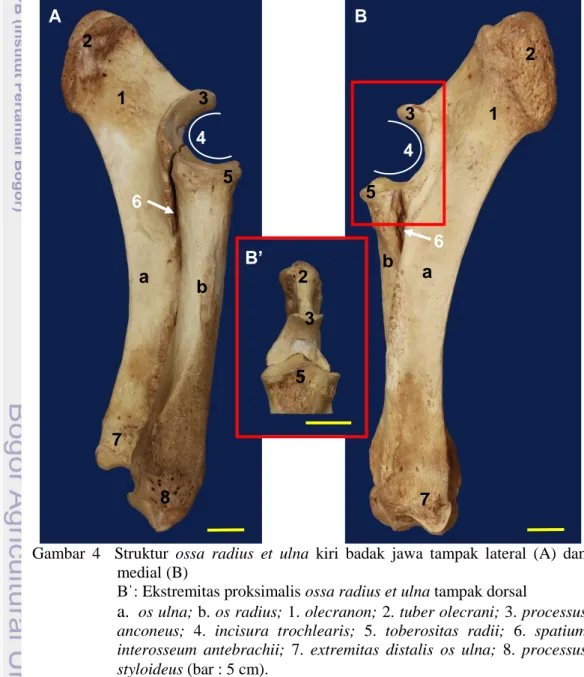 Gambar  4    Struktur  ossa  radius  et  ulna  kiri  badak  jawa  tampak  lateral  (A)  dan      medial (B) 