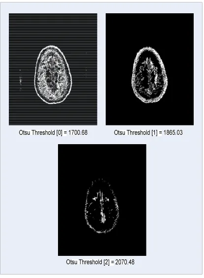 Gambar 4.2 Citra Hasil Segmentasi dengan 3 Threshold