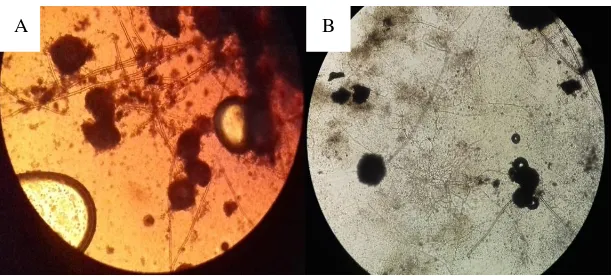 Gambar 2. Hasil Mikroskopik pertumbuhan Aspergillus niger(A: Hifa dan koloni media   Sabouraud Dextrose Agar; B: Hifa dan koloni media sari pati buah sukun) 