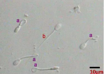 Ilustrasi 3. Pengamatan Keutuhan Membran Plasma Spermatozoa  Sumber: Ariswan, 2014 