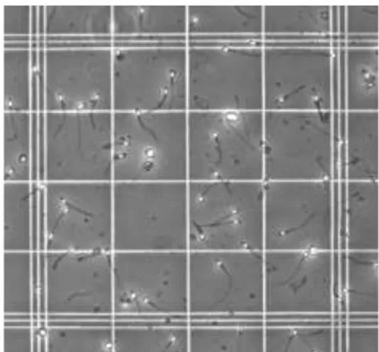 Ilustrasi 1. Pengamatan Motilitas Spermatozoa di Kamar Neubauer  Sumber: Rizal, dkk (2006) 