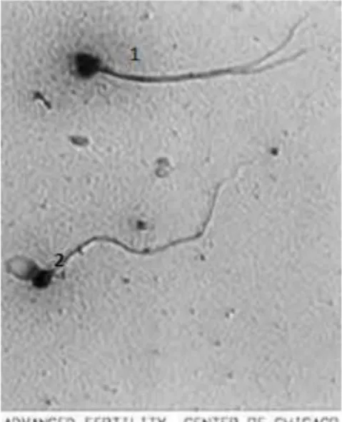 Ilustrasi 2. Pengamatan Abnormalitas Spermatozoa  Sumber: Lodhi, dkk, 2008 