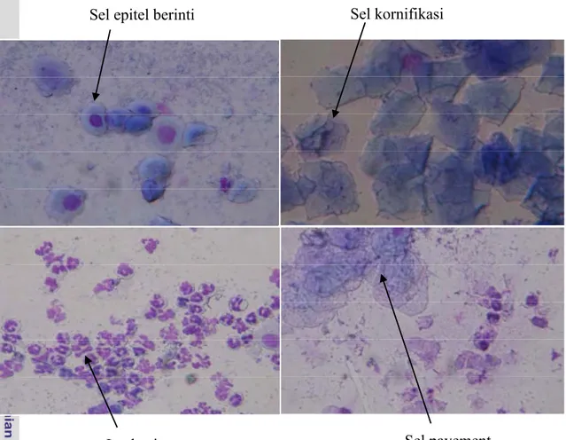 Gambar 5. Gambaran ulas vagina tikus putih galur Sprague-Dawley dengan  pembesaran 40x10