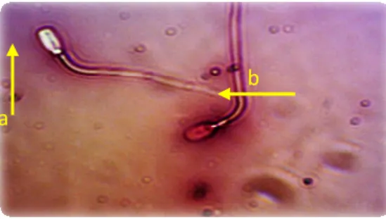 Gambar 1. Spermatozoa hidup dan mati dengan pewarnaan eosin nigrosin (a) spermatozoa  hidup dan (b) spermatooza mati (perbesaran 400 kali) 