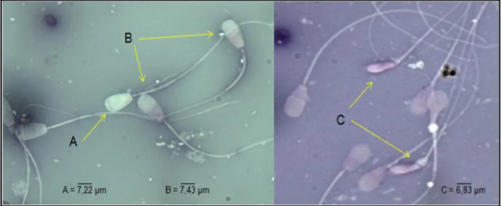 Gambar A. Spermatozoa hidup 