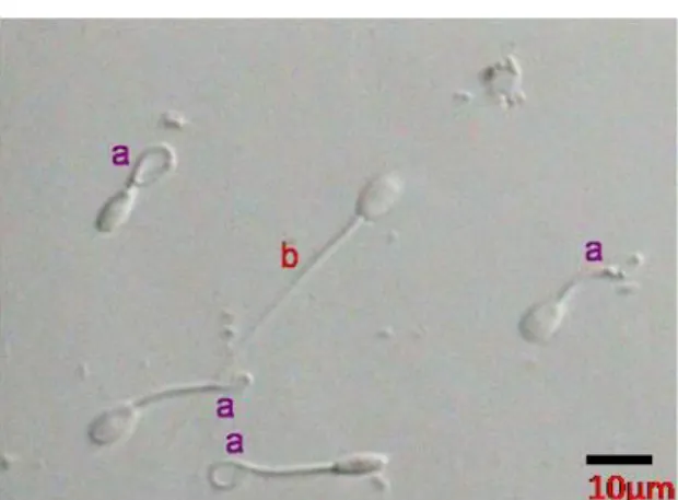 Gambar 1  Spermatozoa bereaksi dengan membran plasma utuh (ekor melingkar, a),  spermatozoa  tidak  bereaksi  dengan  membran  plasma  tidak  utuh  (ekor  lurus, b) (Saili et al