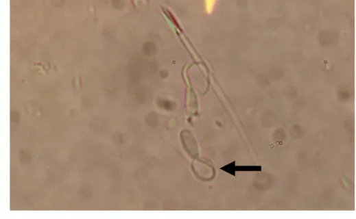 Gambar 5  Reaksi spermatozoa dengan ekor membengkok yang berada pada larutan  hipoosmotik