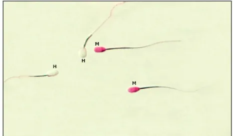 Gambar 10  Bentuk spermatozoa yang hidup (H =  kepala sperma tidak berwarna)  dan mati (M = kepala sperma berwarna merah) 