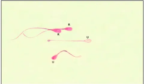 Gambar 11  Bentuk membran plasma yang utuh (U=ekor sperma yang  melingkar)  dan rusak (R=ekor sperma lurus)