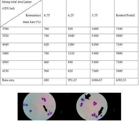Tabel 3 Jumlah C. albicans setelah diinduksi makrofag yang telah diberikan konsentrasi MIC (6,25%), MFC (8,75%) dan 3,75% daun kare