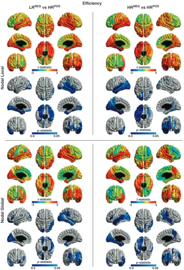 Figure 1.The comparison of nodal local and nodal global efreductions in nodal global efangular and supramarginal gyri