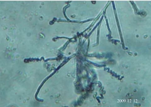 Figure 1. SCASpirales spore chains of the actinobacteria Streptomyces sp. 72 using light microscopy at 100伊.
