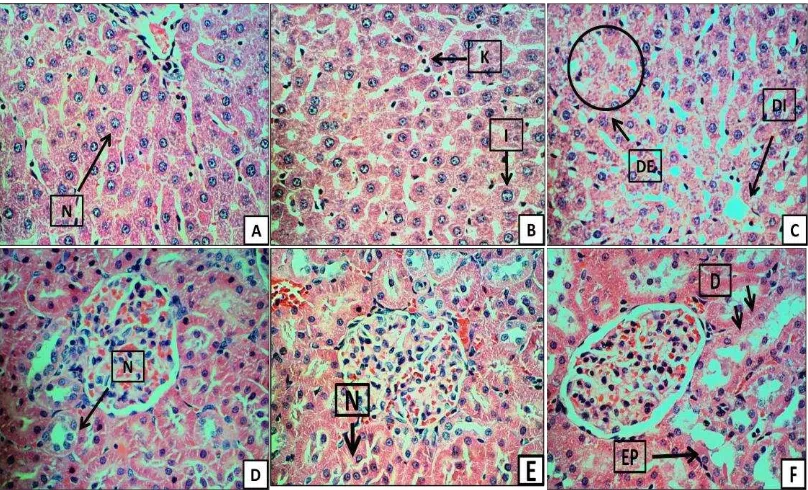 Gambar 1 Gambaran histopatologi hati tikus (A) tikus kontrol, (B) pemberian dosis 15 mg/kg BB, (C) pemberian dosis 105 mg/kg BB