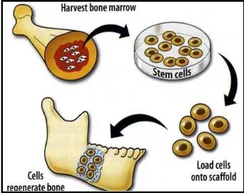 Gambar. 8 Sel punca dewasa bisa didapat dari sumsum tulang yang dikembangkan di laboratorium