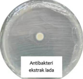 Gambar 2. Uji antibakteri ekstrak buah lada 
