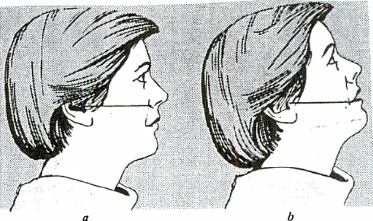 Gambar 3. Posisi kepala yang benar untuk gigi rahang atas dan  rahang bawah (Margono, 1998) 