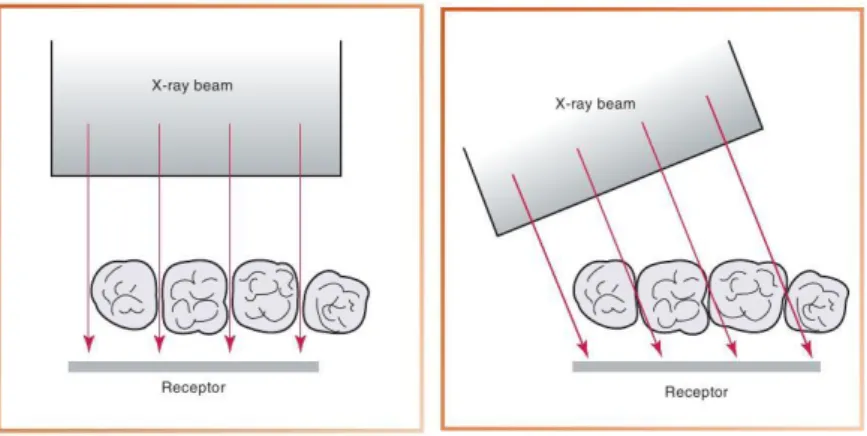 Gambar  4.  Angulasi  horizontal  yang  benar  (kiri)  dan  yang  salah (kanan) (Iannucci &amp; Howerton, 2012) 