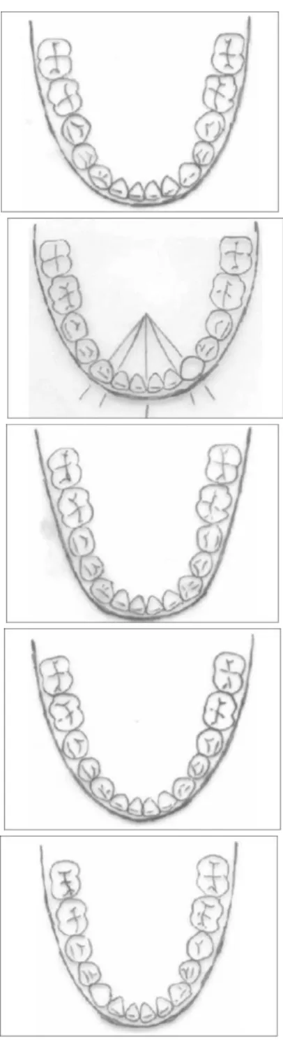 Gambar 8. Bentuk lengkung gigi Ricketts Pentamorphic (Jain &amp; 