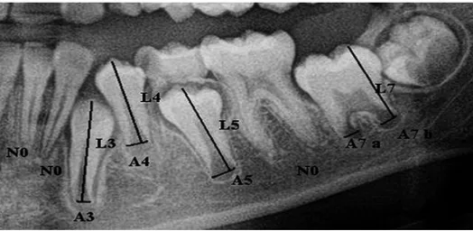 Gambar 1. Sebuah contoh  pengukuran gigi. A i , i=1,..., 5 (gigi dengan  satu akar), adalah jarak antara sisi dalam dari puncak akar terbuka;  