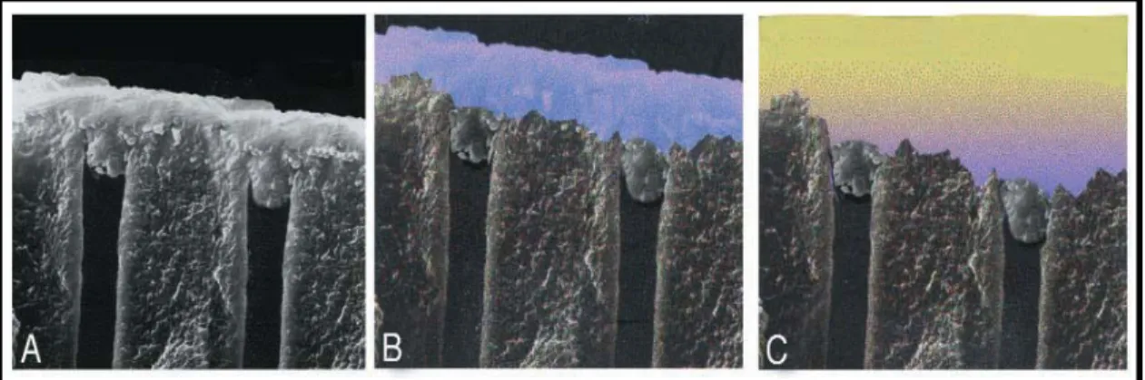 Gambar  5. Mekanisme perlekatan self-etching primer  A.  smear layer  yang melekat pada permukaan  dentin B