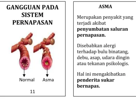 Gambar 2.12 Flashcard Penyakit Asma (Norma, 2012) 