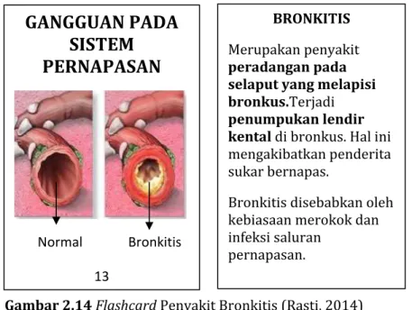 Gambar 2.14 Flashcard Penyakit Bronkitis (Rasti, 2014) 
