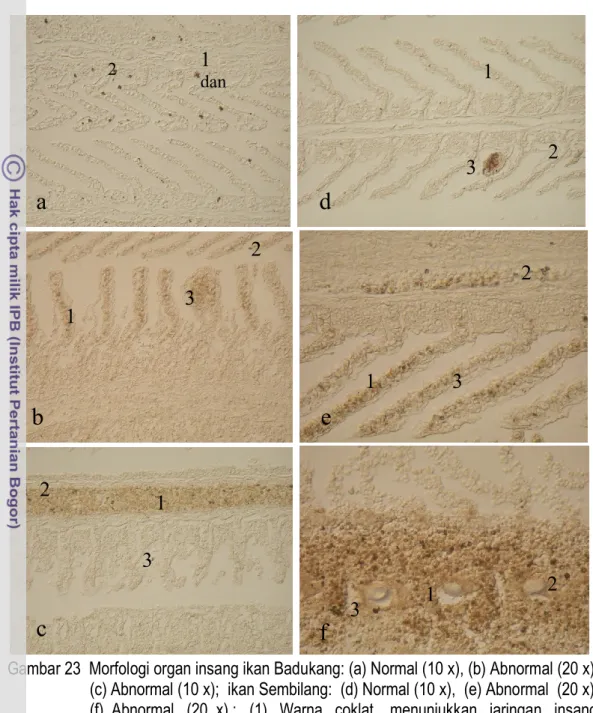 Gambar 23  Morfologi organ insang ikan Badukang: (a) Normal (10 x), (b) Abnormal (20 x),                                           (c) Abnormal (10 x);  ikan Sembilang:  (d) Normal (10 x),  (e) Abnormal  (20 x),   