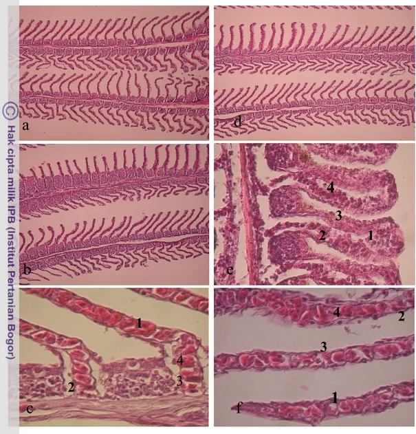 Gambar 24  Morfologi organ insang ikan Badukang: (a) Normal (10 x), (b) Abnormal (10 x),                                             (c)  Abnormal (40 x); ikan Sembilang: (d)  Normal (10 x),  (e)  Abnormal (20 x),                                           