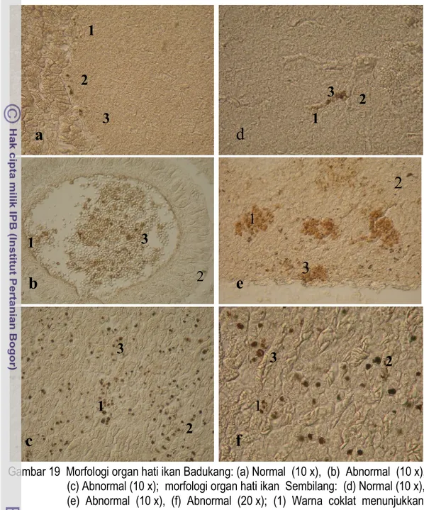 Gambar 19  Morfologi organ hati ikan Badukang: (a) Normal  (10 x),  (b)  Abnormal  (10 x),           (c) Abnormal (10 x);  morfologi organ hati ikan  Sembilang:  (d) Normal (10 x),             (e)  Abnormal  (10 x),  (f)  Abnormal  (20 x);  (1)  Warna  cok