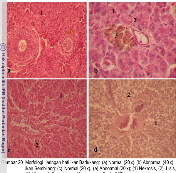 Gambar 20  Morfologi  jaringan hati ikan Badukang:  (a) Normal (20 x), (b) Abnormal (40 x);                            ikan Sembilang: (c)  Normal (20 x),    (e) Abnormal (20 x); (1) Nekrosis, (2)  Lisis,  