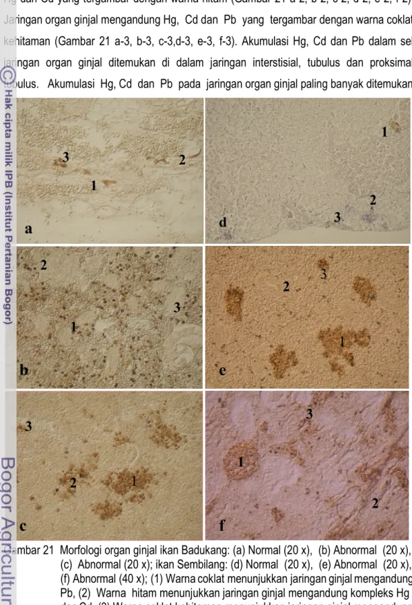 Gambar 21  Morfologi organ ginjal ikan Badukang: (a) Normal (20 x),  (b) Abnormal  (20 x),                        (c)  Abnormal (20 x); ikan Sembilang: (d) Normal  (20 x),  (e) Abnormal  (20 x),                        (f) Abnormal (40 x); (1) Warna coklat 