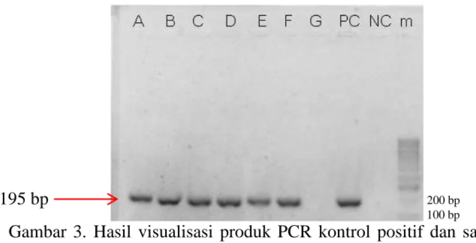 Gambar 3. Hasil visualisasi produk PCR kontrol positif dan sampel dengan  primer CB. 