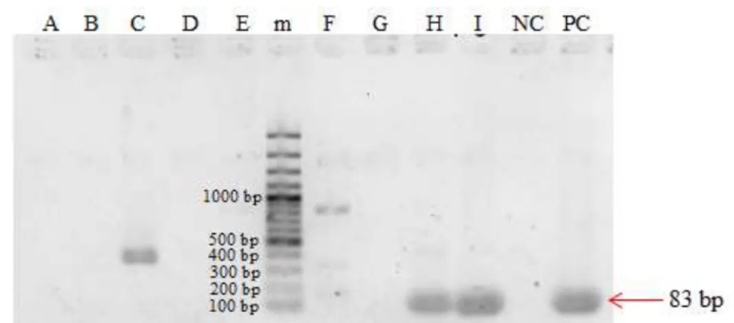Gambar 5. Hasil visualisasi produk PCR kontrol positif dan sampel dengan  primer PPA6 