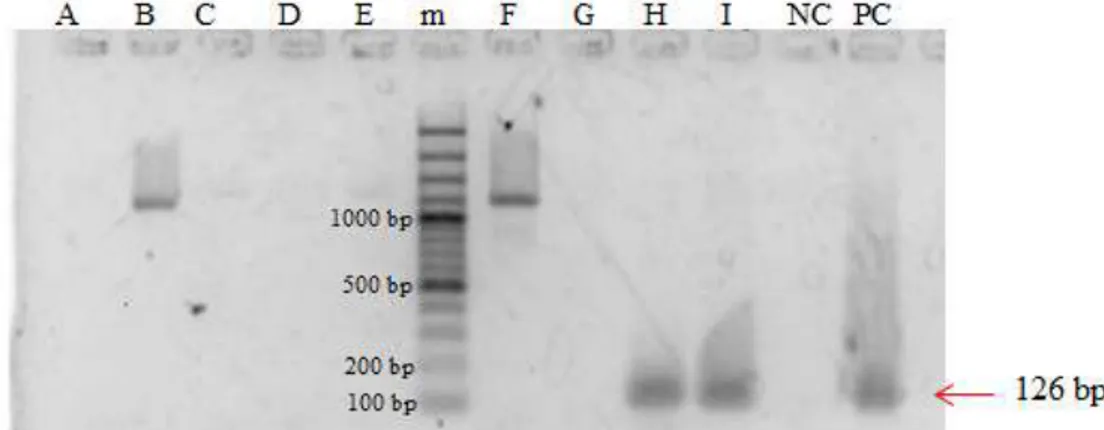 Gambar 5. Hasil visualisasi produk PCR kontrol positif dan sampel dengan  primer PPA8 