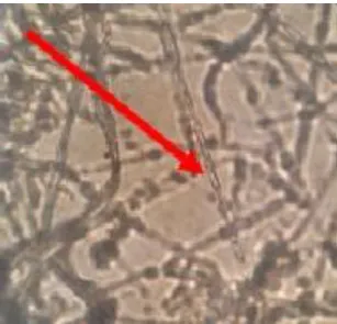 Gambar 6.  Uji Antagonisme Pertumbuhan LC4 dan Ganoderma boninense dari hari ke hari 