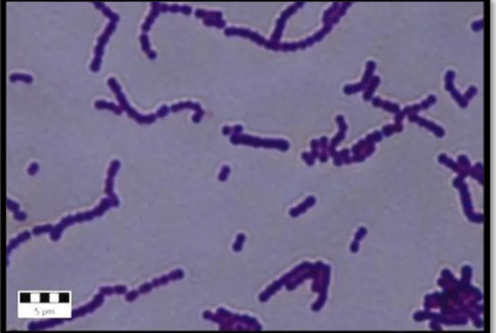 Gambar 3. Morfologi  Streptococcus agalactiae yang diamati melalui mikroskop.  Pembesaran 100x (Anonim, 2010) 
