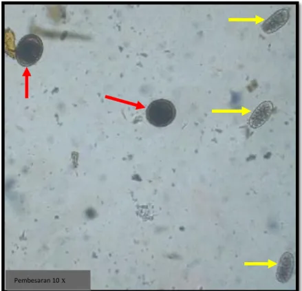 Gambar 12. Telur Toxocara canis (panah merah) dan telur Ancylostoma  caninum (panah kuning) 