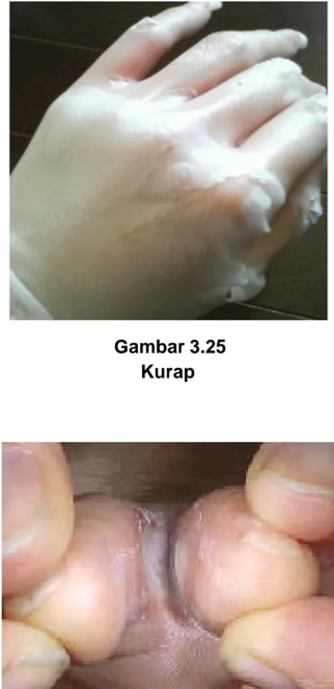 Gambar 3.25  Kurap 