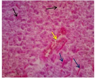 Gambar 2. Adanya infiltrasi akumulasi sel-sel  radang  (panah  biru)  pada  usus.  Pembesaran  400x,  Pewarnaan  HE  