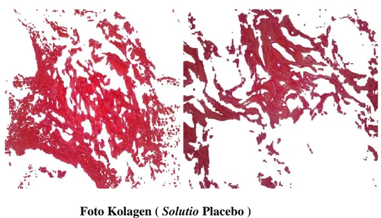 Foto Kolagen ( Solutio Ekstrak kulit manggis 95% ) 