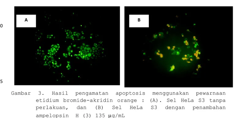 Gambar  3.  Hasil  pengamatan  apoptosis  menggunakan  pewarnaan  etidium  bromide-akridin  orange  :  (A)