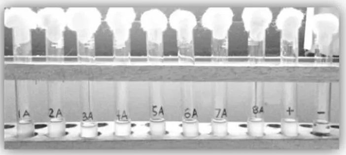Gambar 1: Hasil uji kepekaan antibakteri secara  dilusi infusa umbi rumput teki (rhizome Cyperus 