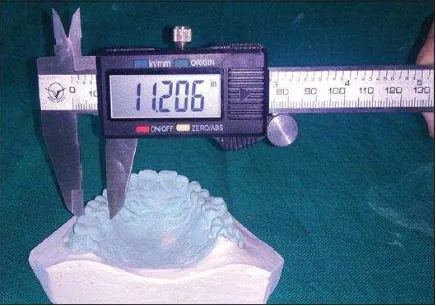 Figure 1. Tooth measurements a on a dental arch plaster model 