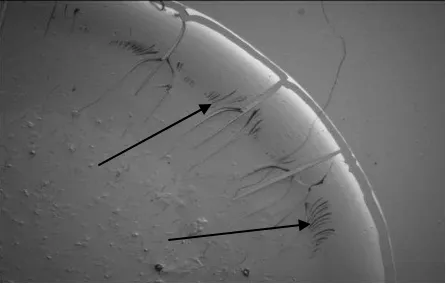 Figure 2. Crescent structures in blood serum facies without short folds. 