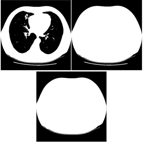 Figure 3. Extraction of body mask in a CT image 